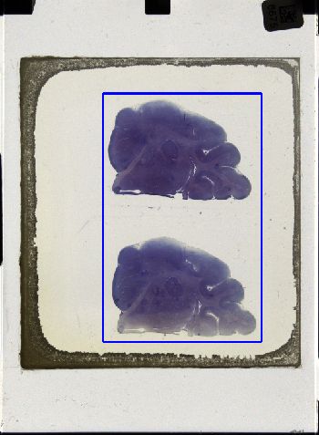 Media type: image; Special Collections 3043   shows specimen_part histological serial section;